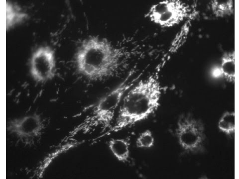 ¿Qué pasa con la piel muerta?