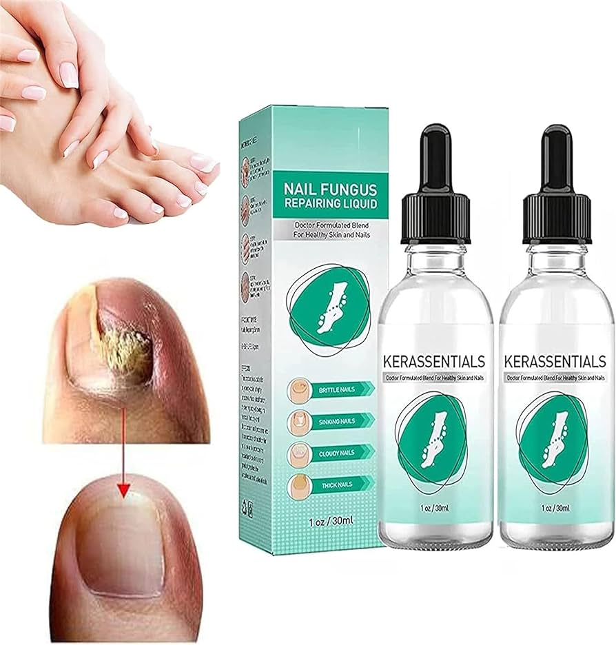 aceite fungicida para unas