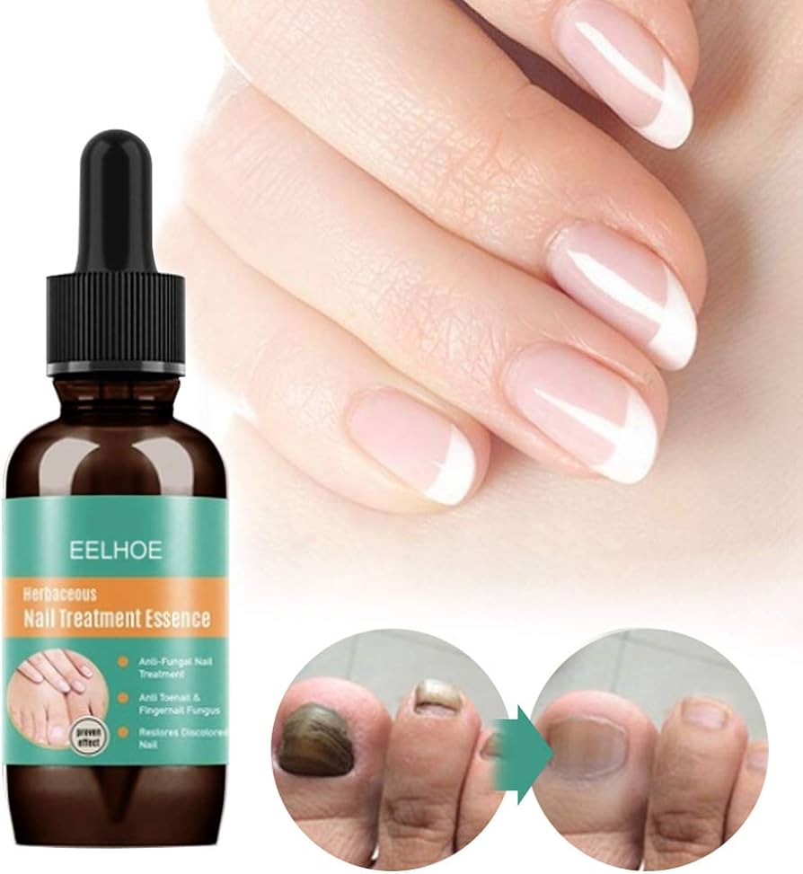 aceite para unas con hongos