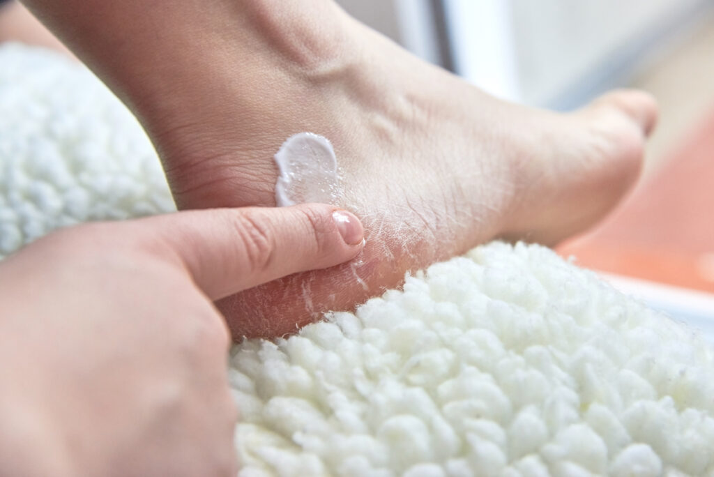 como hidratar los pies con vaselina