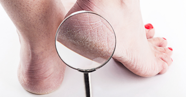 como suavizar los talones de los pies