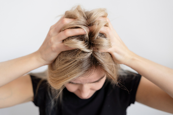 puede el serum capilar causar la acumulacion de productos en el cabello