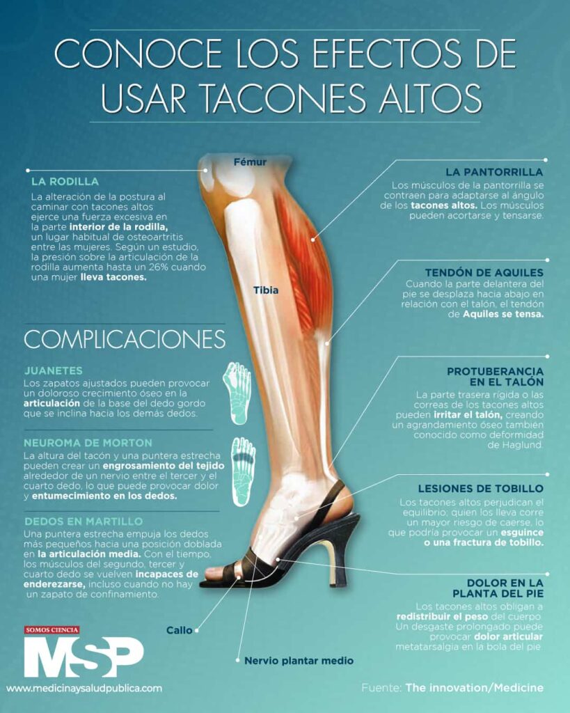 puede el uso de tacones altos causar problemas en los pies