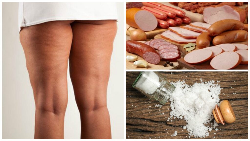 que debo comer para eliminar la celulitis