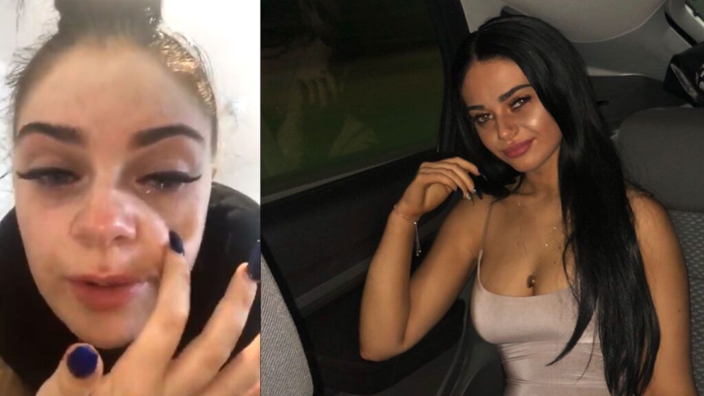 que pasa si me pego las pestanas con pegamento de unas