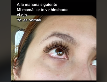 que pasa si te entra en el ojo pegamento de pestanas postizas